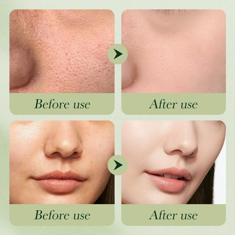 6pc Avocado Skincare Set